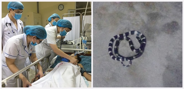 Cứu sống bệnh nhi bị rắn độc cắn