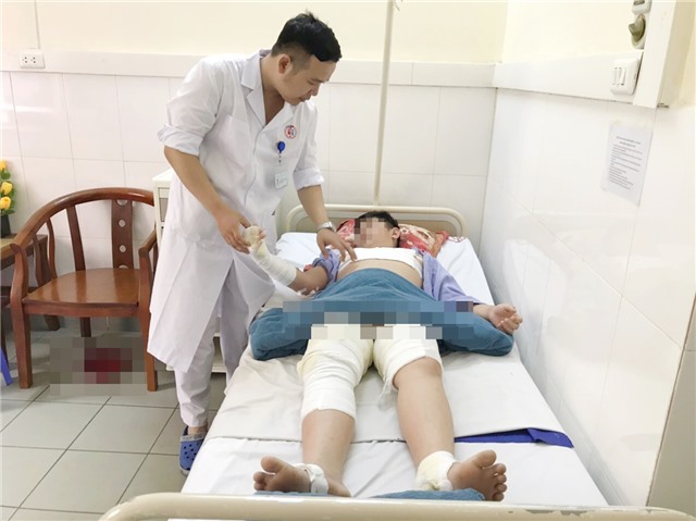 Cảnh báo tình trạng tai nạn thương tích trẻ em do bỏng cồn và pháo nổ tự chế