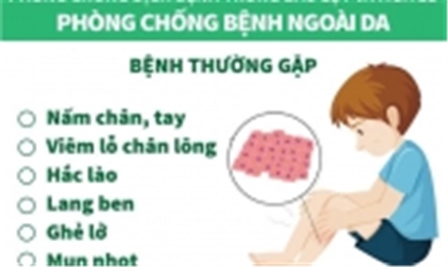 [Graphic] Cách phòng chống dịch bệnh mùa mưa bão đơn giản, dễ hiểu