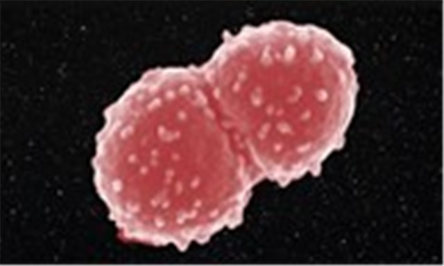 Phát hiện loài vi khuẩn có thể sống trên vũ trụ