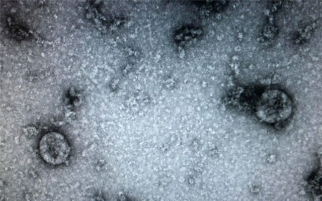 Việt Nam nuôi cấy và phân lập thành công virus corona mới (nCoV)