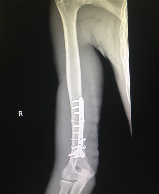 Cảnh báo nguy hiểm từ trò vật tay