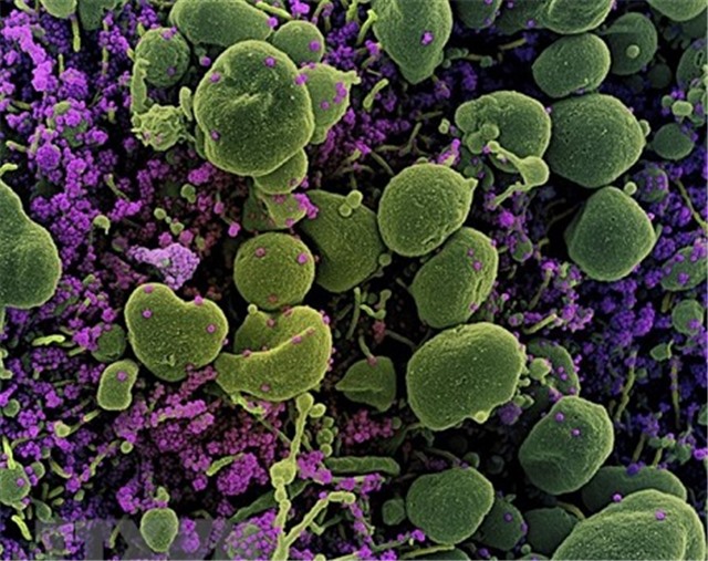 Phát hiện trường hợp mang 18 đột biến của SARS-CoV-2