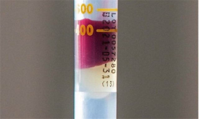 Nồng độ kháng thể Covid-19 mỗi người khác nhau