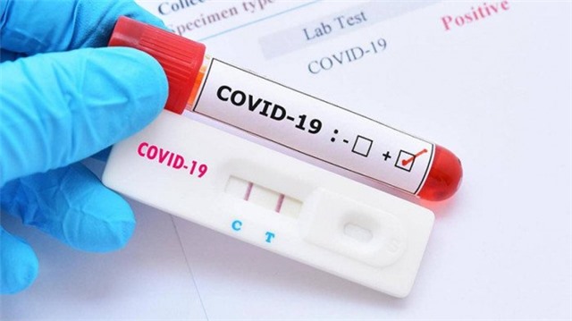 Trước ngày 20/11/2021, TP Uông Bí hoàn thành xét nghiệm toàn dân