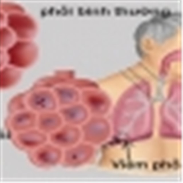 Sáng 12/4: Hà Nội và Thái Nguyên có thêm 3 ca mắc COVID-19