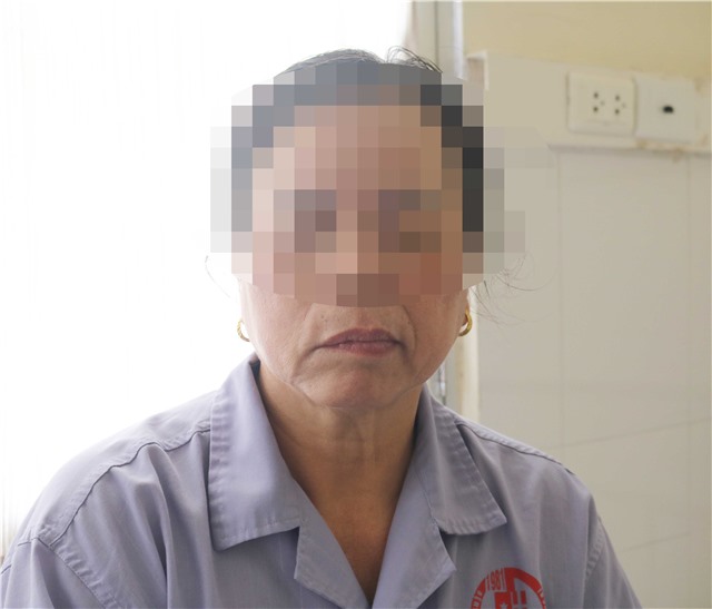 Người bệnh bị méo miệng, mắt không nhắm được do tắm muộn