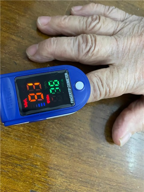 Tình trạng "thiếu oxy thầm lặng": Nguy cơ khiến bệnh nhân COVID - 19 trở nặng