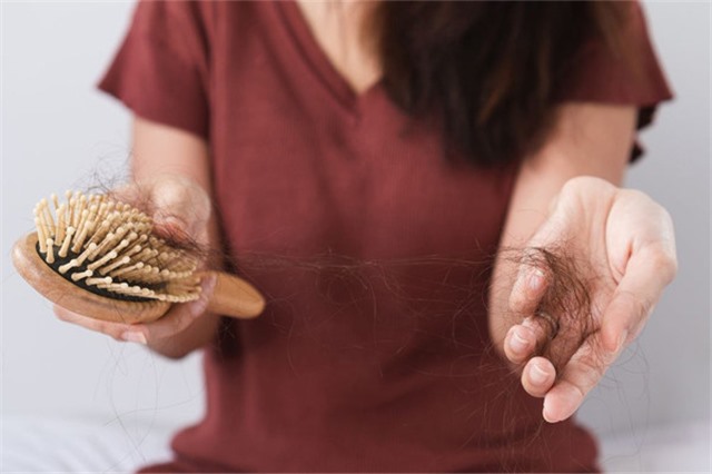 Lý do người từng nhiễm Covid-19 bị rụng tóc nhiều không tưởng