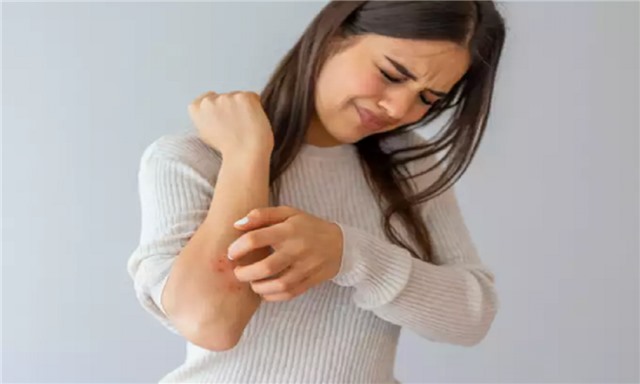 Những di chứng hậu COVID-19 cần lưu ý