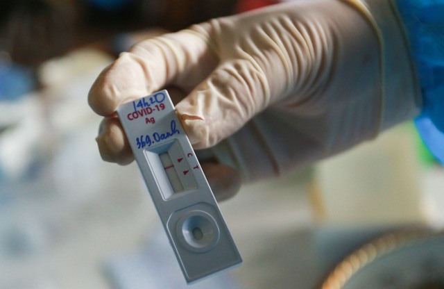 Ai có nguy cơ tái nhiễm COVID-19 cao hơn?