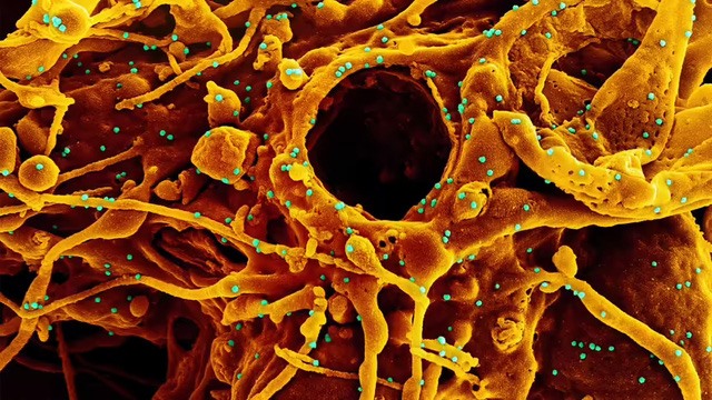 6 thông tin cặn kẽ nhất về biến thể phụ BA.2 "tàng hình" của Omicron