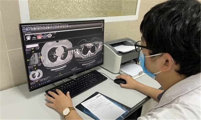 Sáng 3/8: Biến thể BA.4, BA.5 lây lan nhanh bắt đầu chiếm ưu thế; F0 bệnh nền, cần nhập viện, có thể có triệu chứng hậu COVID-19 đến 80%