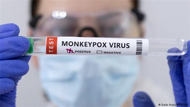 Số ca mắc đậu mùa khỉ vẫn tiếp tục tăng tại nhiều nước