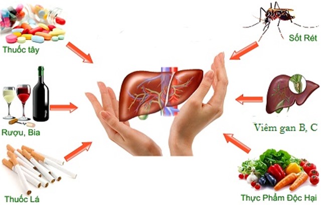 Nếu thấy dấu hiệu này, có thể con bạn đã mắc suy gan cấp