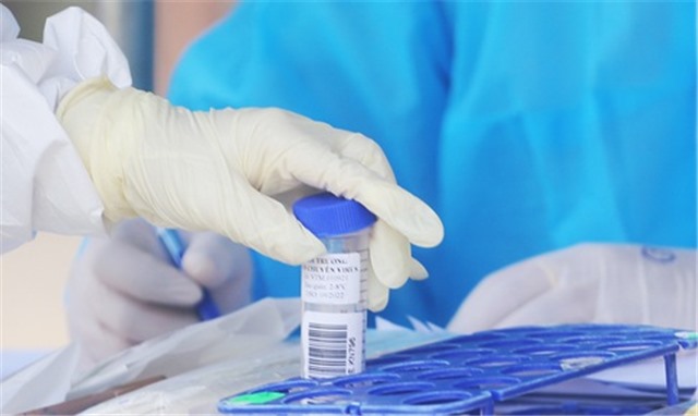 Sáng 6/9: Bệnh nhân COVID-19 nặng tăng nhanh, theo dõi chặt sự xuất hiện các biến thể mới