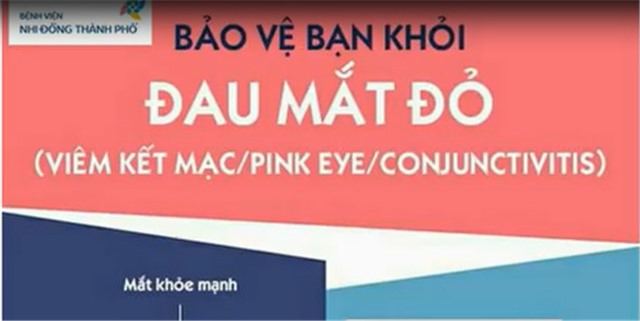 Thành phố chỉ đạo tăng cường các biện pháp phòng chống bệnh đau mắt đỏ