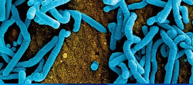 Bệnh do virus Marburg có tỉ lệ tử vong cao nhưng không dễ lây, chuyên gia lý giải