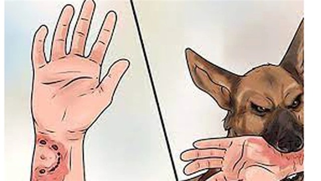 Nhiều tỉnh, thành phố ghi nhận có người chết do bệnh dại