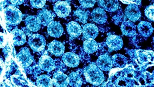 Dịch Covid-19 đang bùng phát mạnh trở lại ở Hàn Quốc