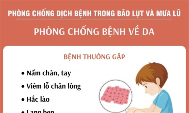 Phòng chống bệnh ngoài da trong mùa bão lụt và mưa lũ