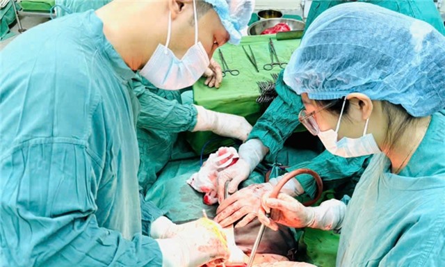 Cắt khối u xơ tử cung “khổng lồ” cho nữ bệnh nhân 47 tuổi